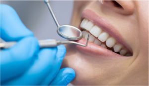 Oral Hygiene